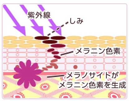 しみ、メラニン色素についてのイラスト
